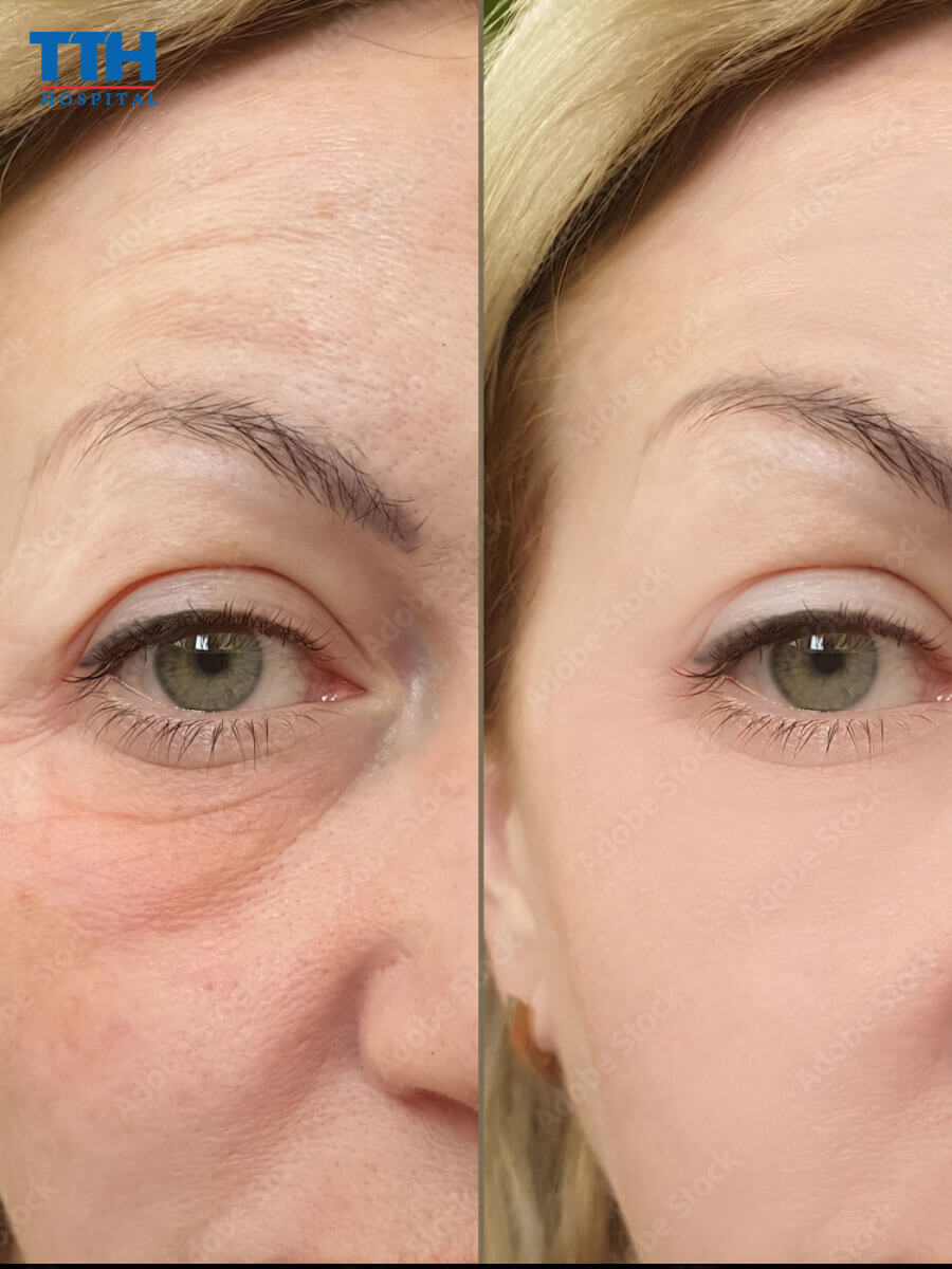 Phân loại của chỉ sinh học Xline