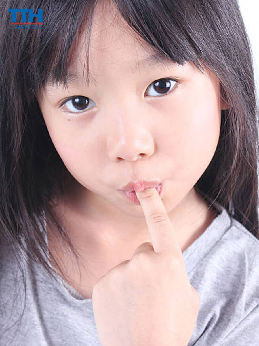 Phòng tránh khớp cắn ngược ở trẻ em