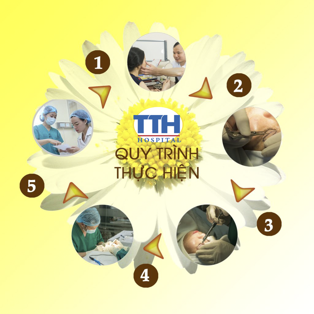Quy trình phẫu thuật thẩm mỹ mắt toàn diện tại bệnh viện Thái Thượng Hoàng được thực hiện theo quy trình chuẩn của Bộ Y tế với 5 bước