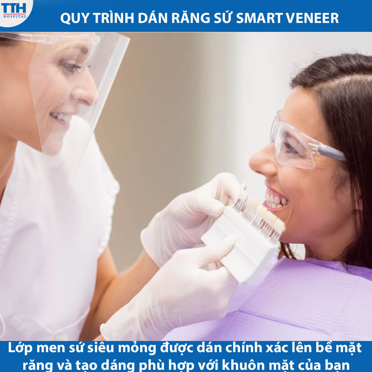 Quy trình dán răng sứ Smart Veneer
