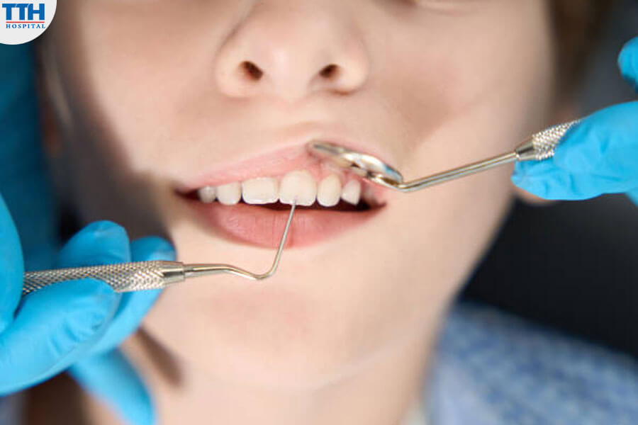 Quy trình gây mê điều trị răng trẻ em