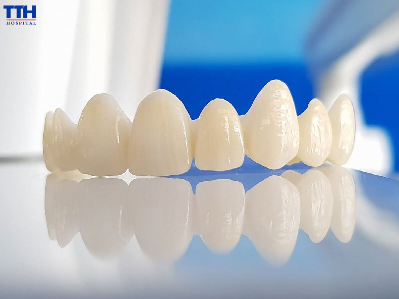 Quy trình làm răng sứ Zirconia