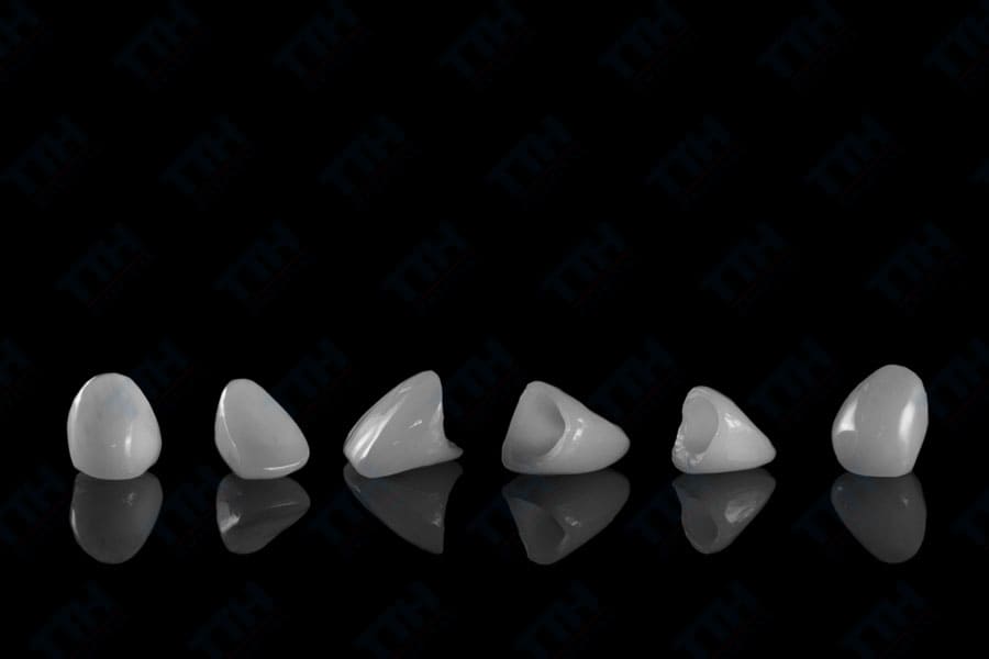 Răng sứ Orodent là gì?