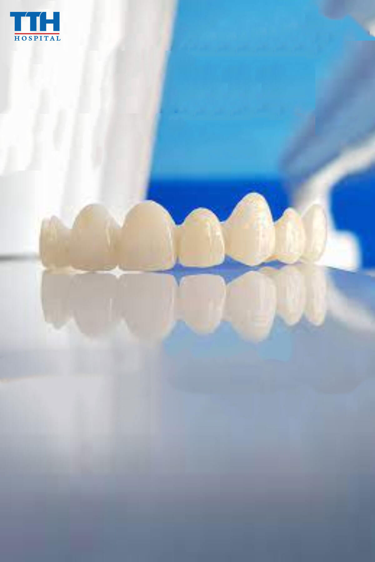 Răng Sứ Porcelain tại Vinh, Nghệ An