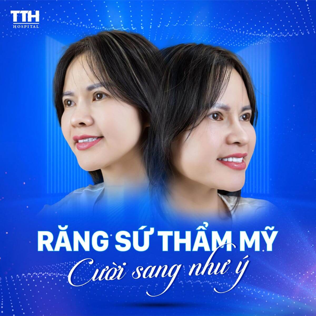 Răng sứ thẩm mỹ