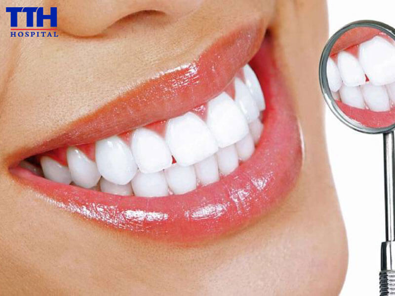 Răng sứ thẩm mỹ là gì?