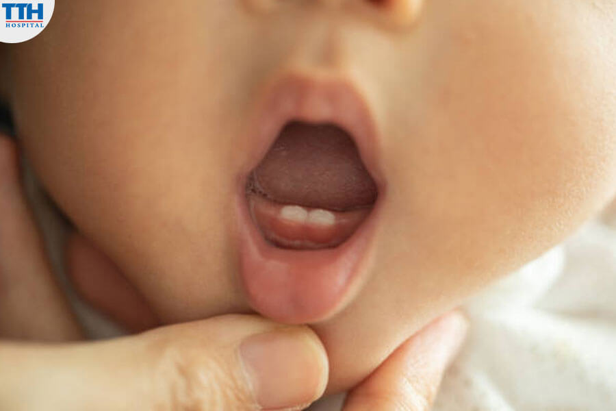 Răng Sữa Là Gì?