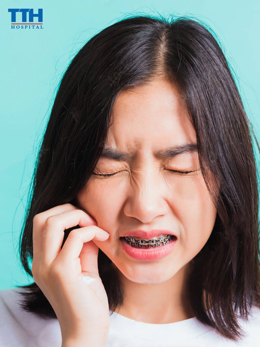  Sự Khó Chịu Của Trẻ Khi Niềng Răng