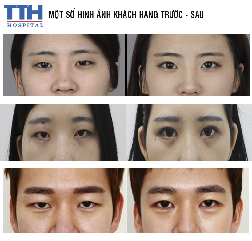 một số hình ảnh khách hàng trước - sau