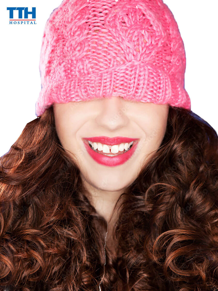 Tác hại của răng thưa