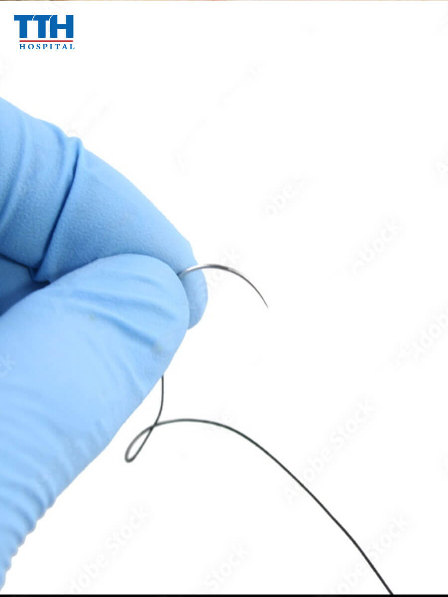 Thành phần cấu tạo của chỉ sinh học Xline