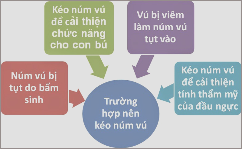 Tụt núm vú được chia theo ba mức độ