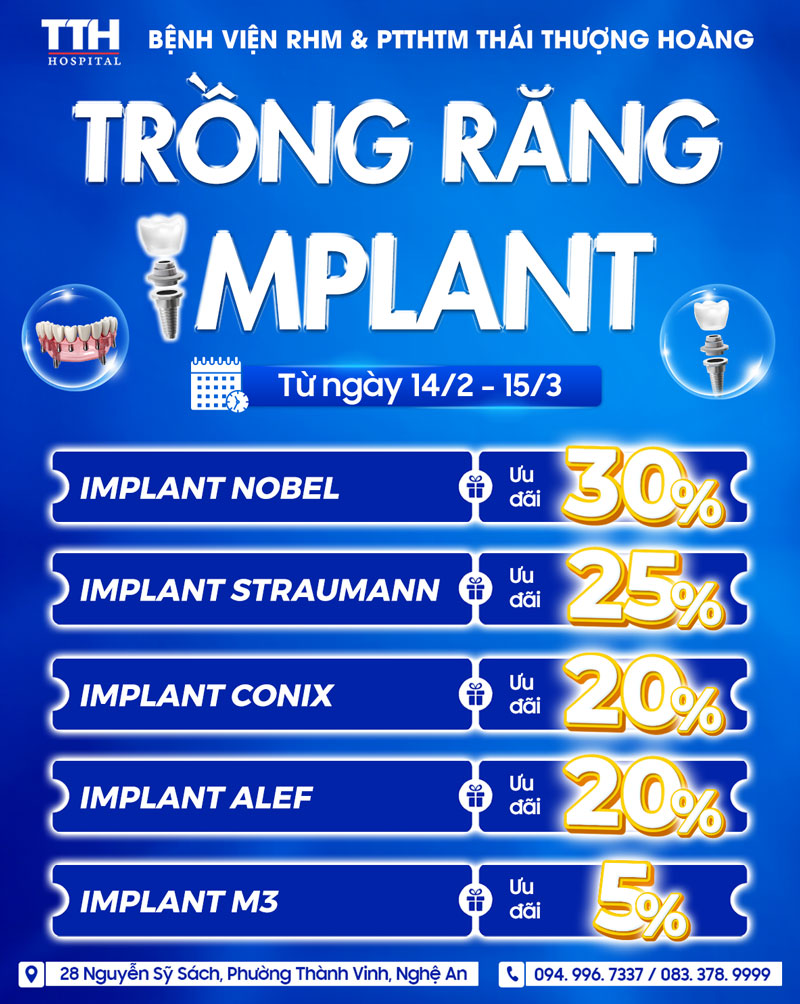 ƯU ĐÃI TRỒNG RĂNG IMPLANT ĐẦU NĂM – GIẢM ĐẾN 30%