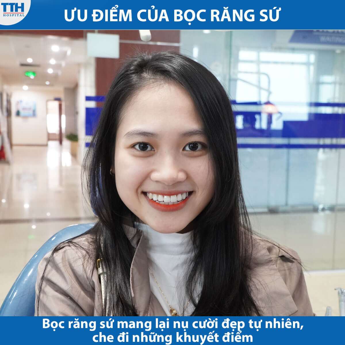 Ưu điểm của bọc răng sứ