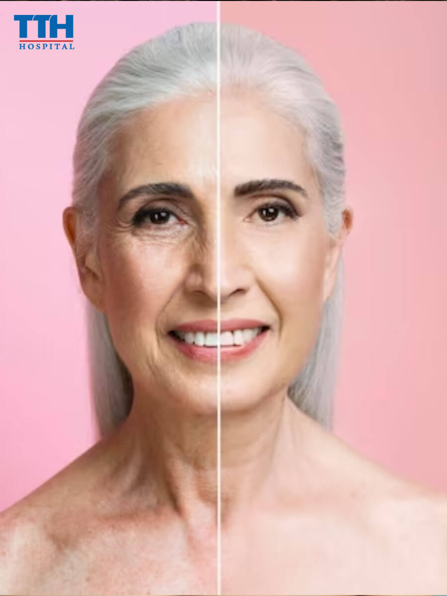 Ưu điểm của căng chỉ sinh học tại vinh nghệ an