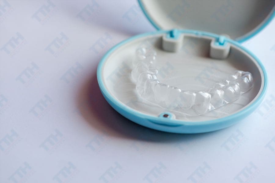 Ưu Điểm Của Invisalign