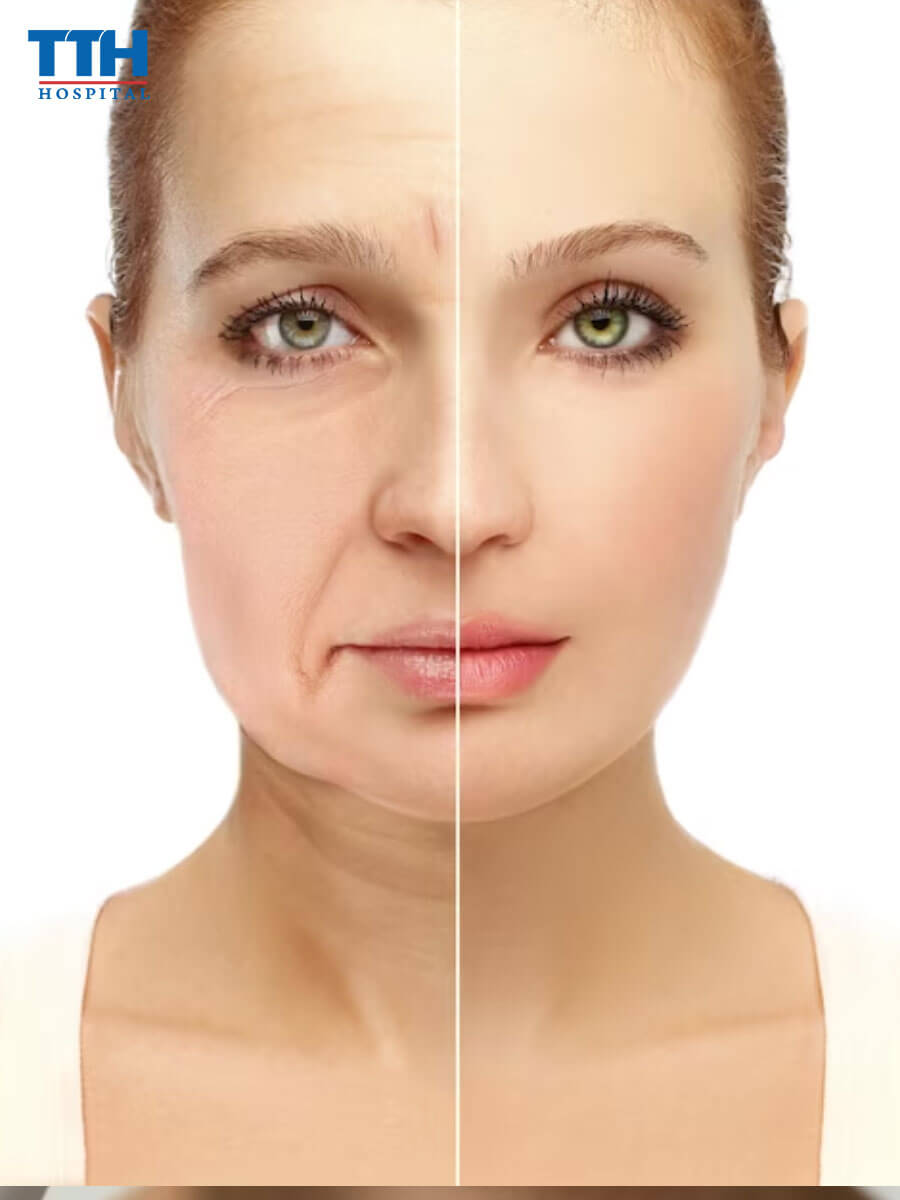 Ưu điểm và nhược điểm của căng chỉ sinh học