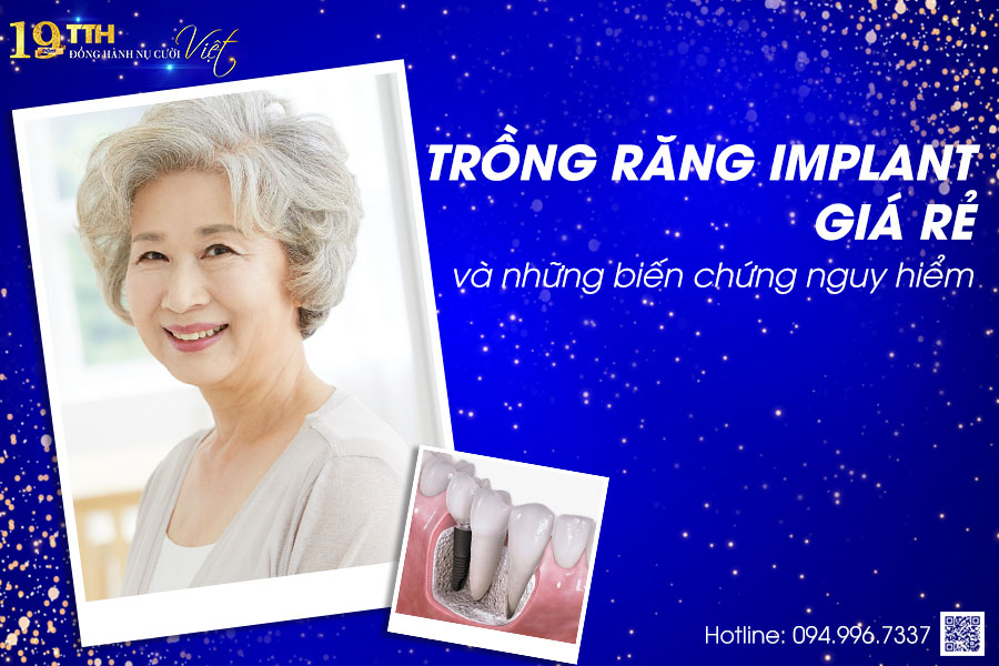 Trồng răng Implant giá rẻ và những hậu quả khôn lường