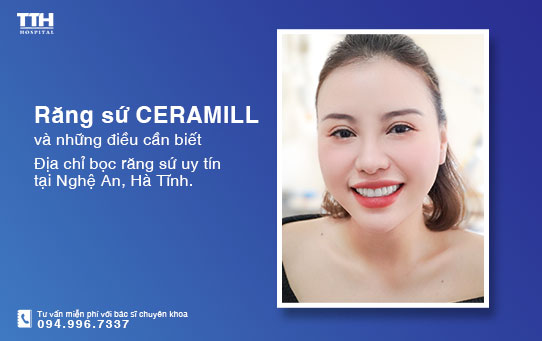 Răng sứ Ceramill và những điều cần biết? Bọc răng sứ uy tín tại Nghệ An, Hà Tĩnh