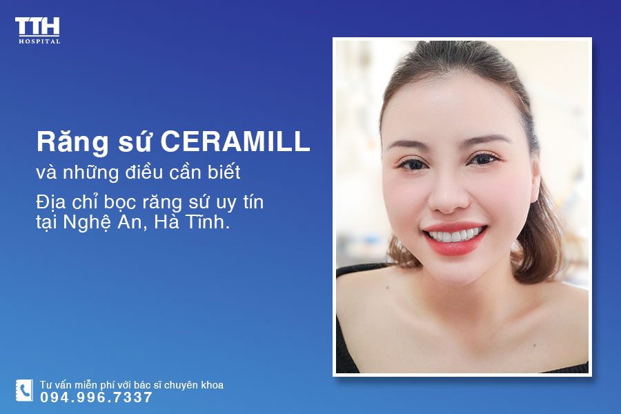 Răng sứ Ceramill và những điều cần biết? Bọc răng sứ uy tín tại Nghệ An, Hà Tĩnh