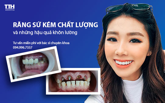 Răng sứ kém chất lượng và những hậu quả khôn lường