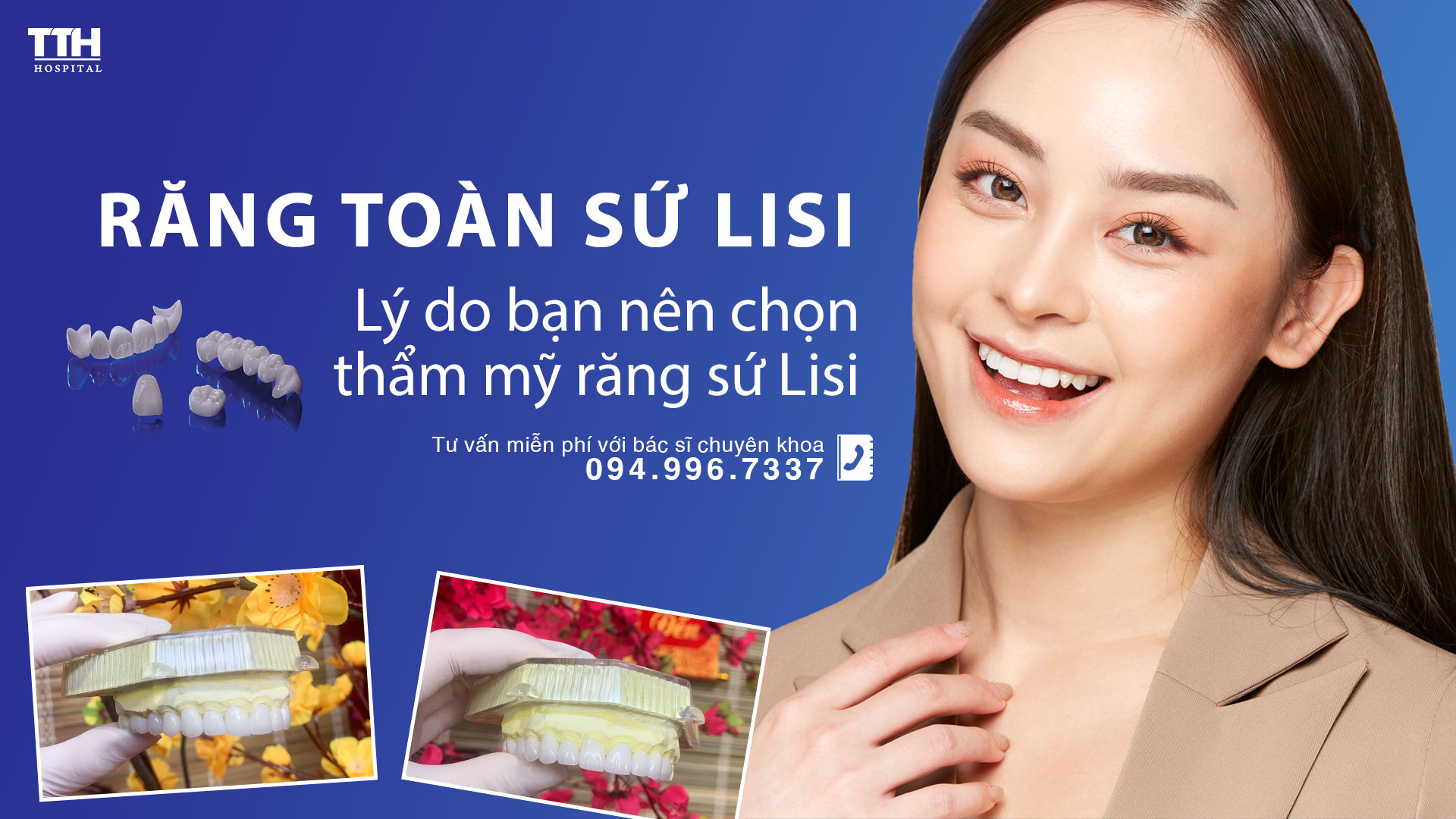 Răng sứ Lisi - Lý do bạn nên chọn thẩm mỹ răng sứ Lisi