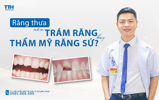 Răng thưa nên trám răng hay bọc răng sứ? Thẩm mỹ răng sứ uy tín tại Nghệ An