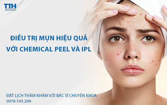 Điều trị mụn hiệu quả với chemical peel và IPL. Bệnh viện Thái Thượng Hoàng - Địa chỉ điều trị và chăm sóc da uy tín Nghệ An, Hà Tĩnh