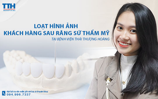 Loạt hình ảnh khách hàng sau răng sứ thẩm mỹ tại Bệnh viện Thái Thượng Hoàng