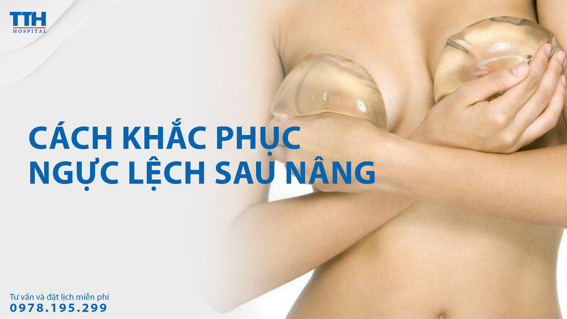 Cách khắc phục ngực lệch sau nâng. Bệnh viện Thái Thượng Hoàng - Địa chỉ nâng ngực uy tín hàng đầu Nghệ An, Hà Tĩnh