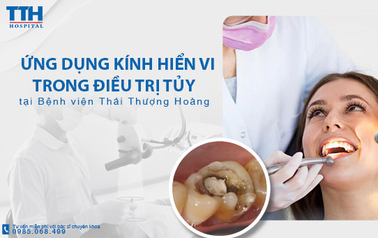 Điều trị tủy hiệu quả cao bằng kính hiển vi tại Bệnh viện Thái Thượng Hoàng