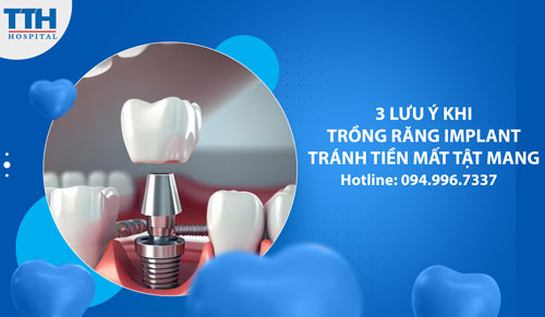 3 lưu ý khi trồng răng Implant để tránh tiền mất tật mang