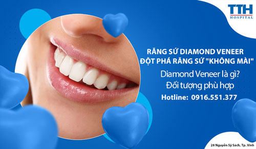 Răng sứ Diamond Veneer - Đột phá răng sứ "không mài"