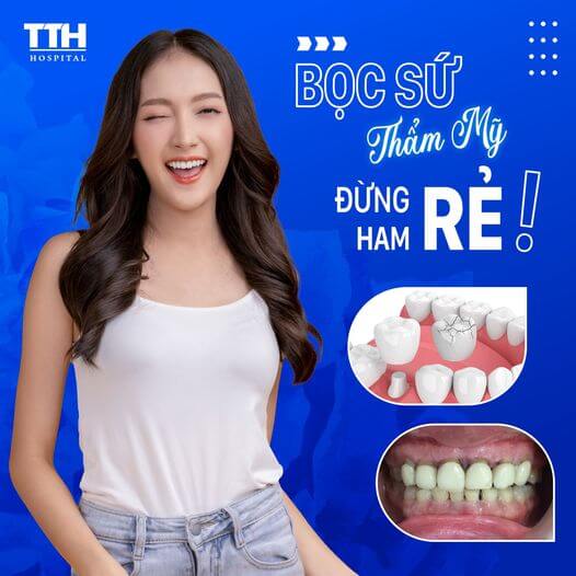 Bọc Răng Sứ Thẩm Mỹ