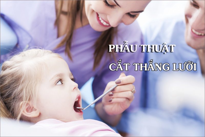 Phẫu thuật cắt thắng lưỡi Thái Thượng Hoàng