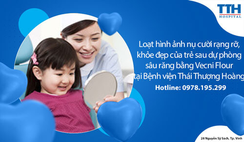 Loạt hình ảnh nụ cười rạng rỡ, khỏe đẹp của trẻ sau dự phòng sâu răng bằng Vecni Flour tại Bệnh viện Thái Thượng Hoàng
