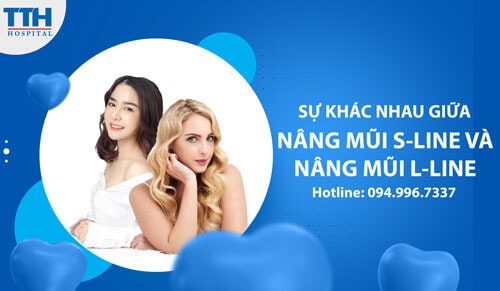 Sự khác nhau giữa nâng mũi S-line và nâng mũi L-line