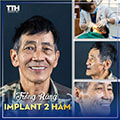 hình ảnh khách hàng trồng răng Implant