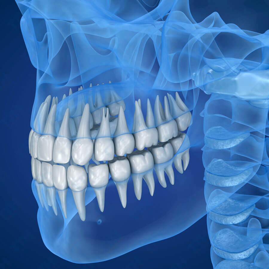 Ai cần phẫu thuật hàm mặt?