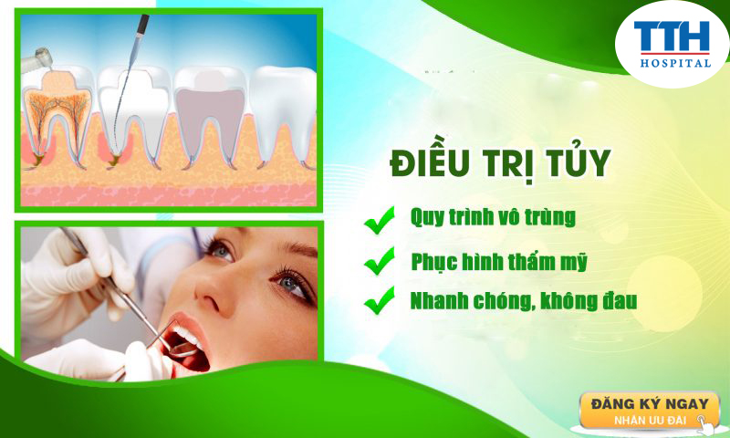 Điều trị tủy răng - Bệnh viện Thái Thượng Hoàng