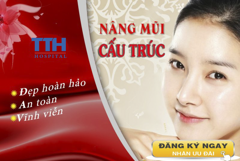 Nâng mũi cấu trúc