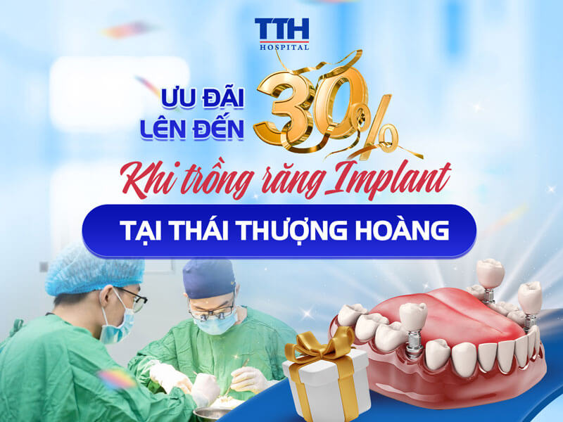 Ưu đãi lớn cho khách hàng trồng răng Implant Nobel