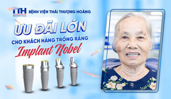 Ưu đãi lớn cho khách hàng trồng răng Implant Nobel