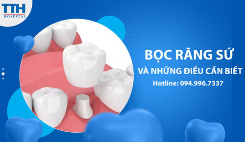 Bọc răng sứ và những điều cần biết