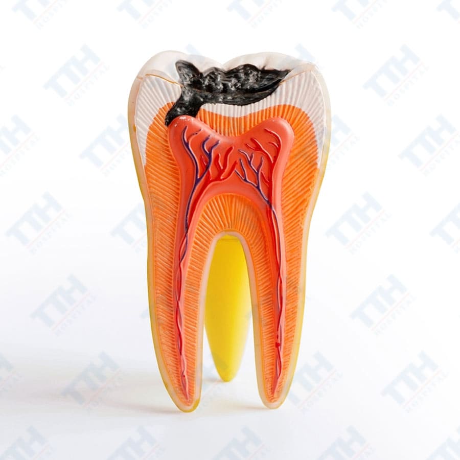 Các dấu hiệu bạn cần điều trị tủy răng