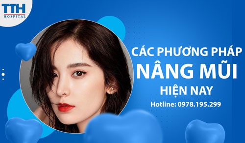 Các phương pháp nâng mũi hiện nay