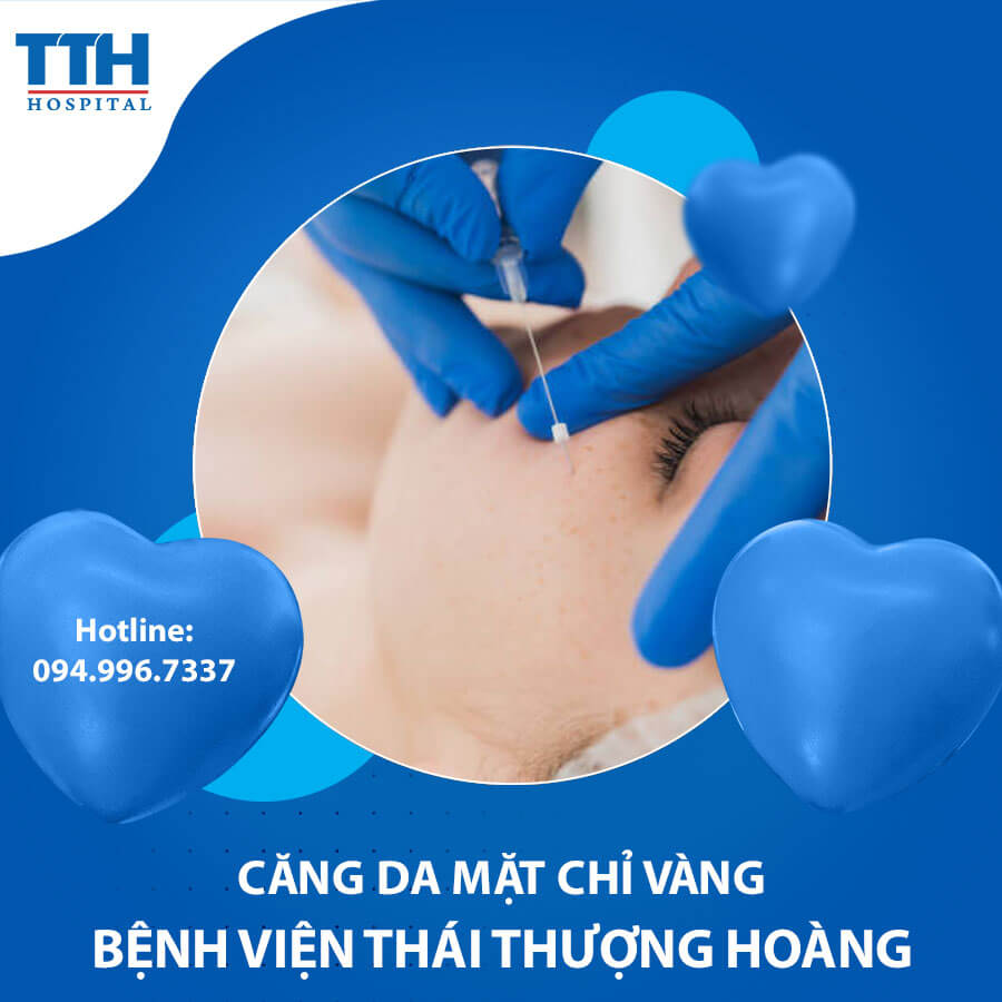 Căng da mặt chỉ vàng