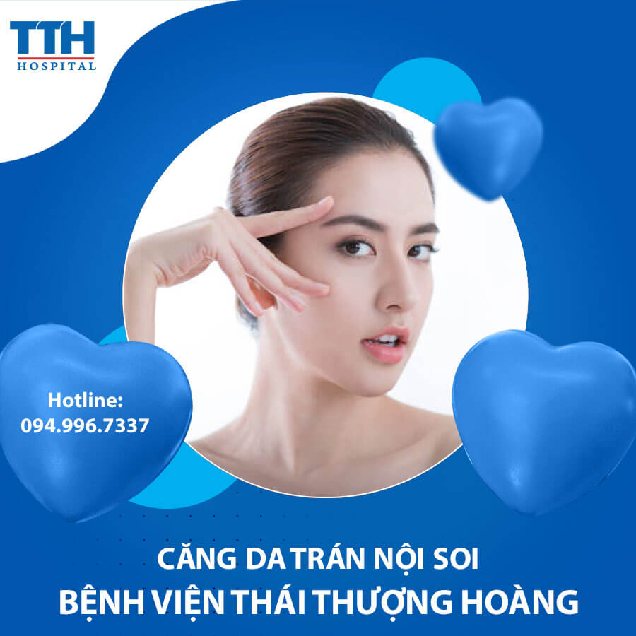 Căng da trán nội soi Thái Thượng Hoàng