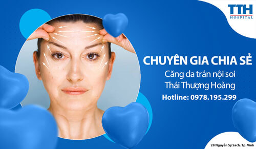 Căng da trán nội soi Thái Thượng Hoàng