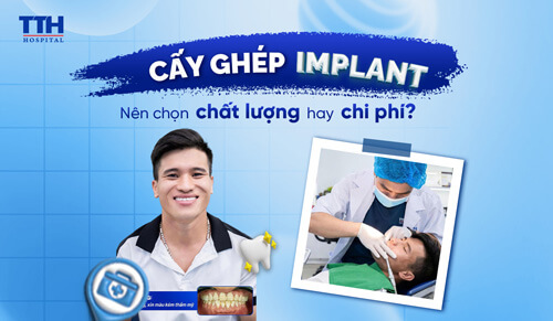 CẤY GHÉP IMPLANT – NÊN CHỌN CHẤT LƯỢNG HAY CHI PHÍ?